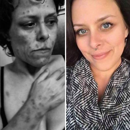 10 фотографий людей до и после преодоления зависимости